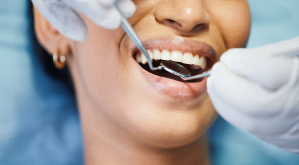Best Emergency Treatment for Oral Infections in Laingsburg, MI