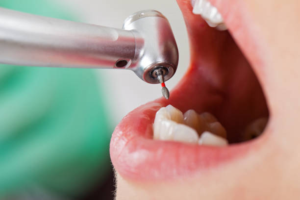 Best Emergency Denture Repair in Laingsburg, MI